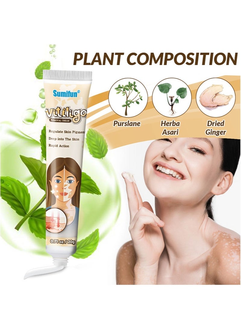 سوميفون كريم لإزالة البهاق 2 قطعة يحسن تصبغ الجلد ويقلل البقع البيضاء، تركيبة طبيعية، مناسب لجميع أنواع البشرة (20 جم + 20 جم) - Image 5